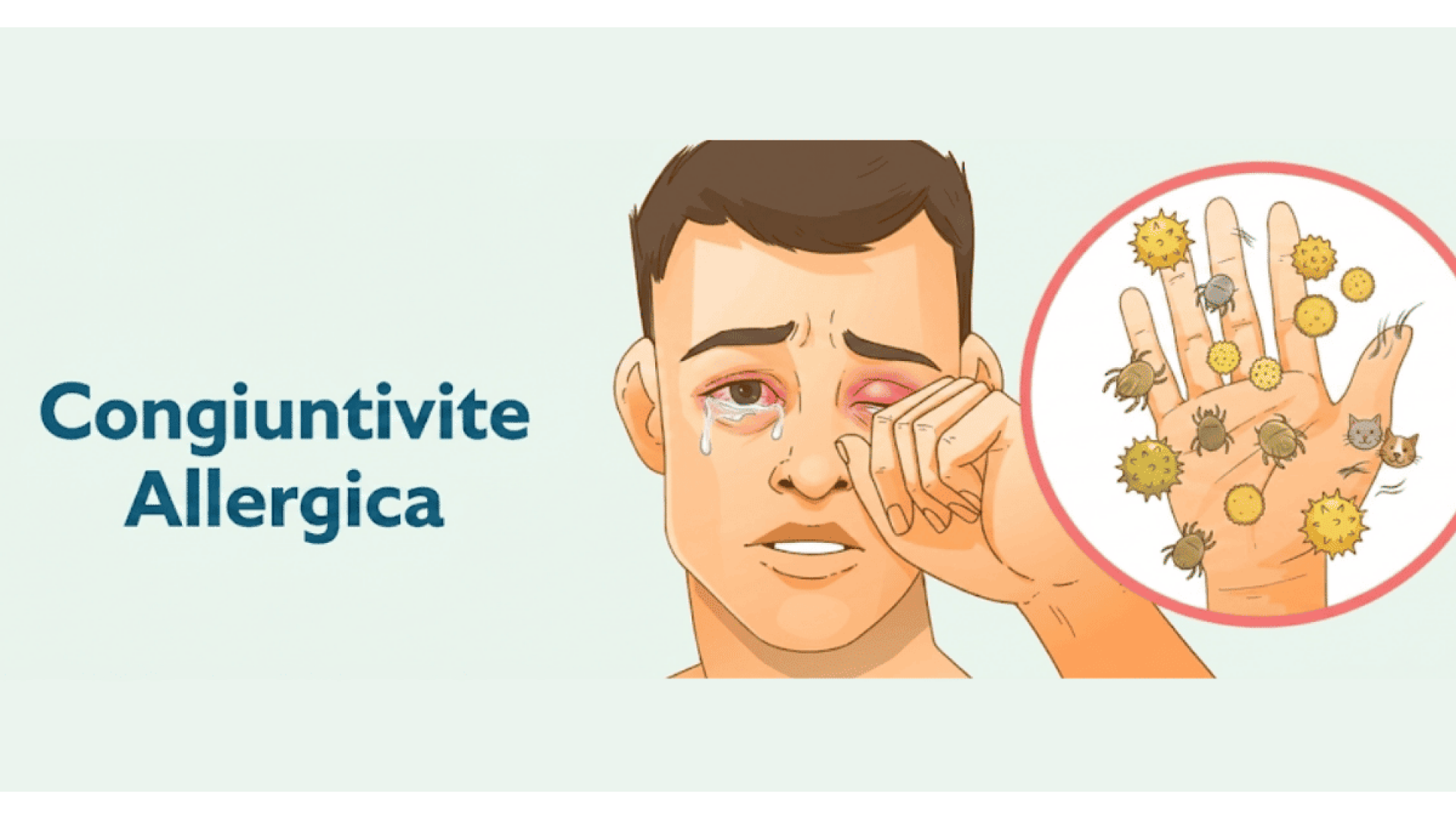 Congiuntivite Allergica: Perché Il Collirio Omeopatico Funziona